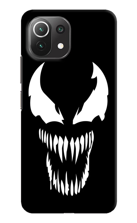 Venom Mi 11 Lite NE 5G Hard Case Back Cover by Casekaro
