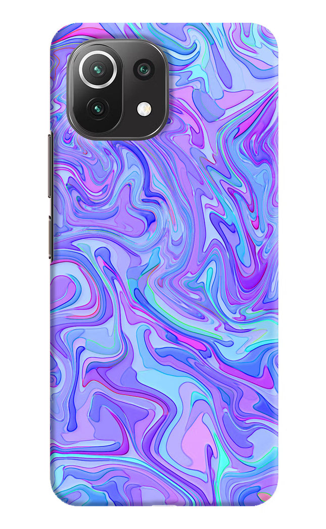 Glitter Mi 11 Lite NE 5G Hard Case Back Cover by Casekaro