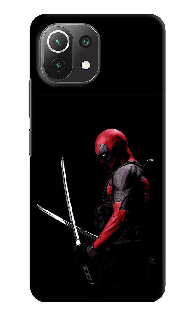 Deadpool Mi 11 Lite NE 5G Hard Case Back Cover by Casekaro