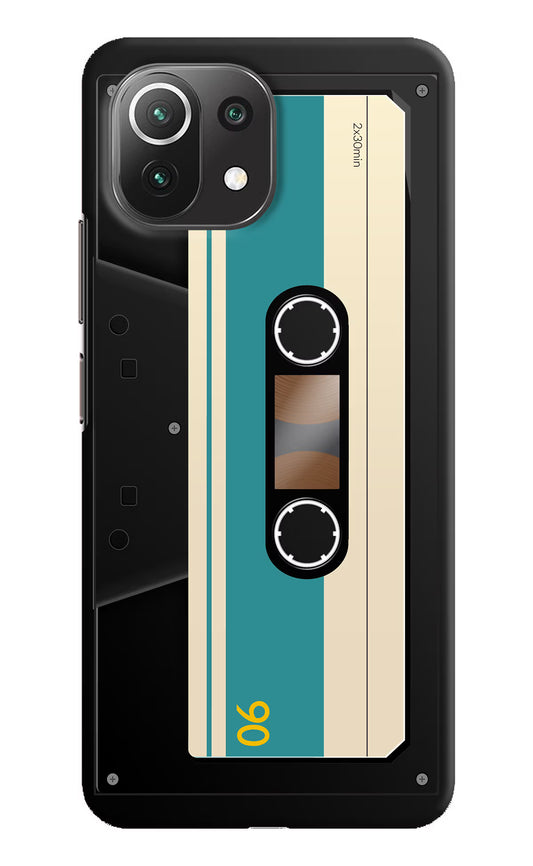 Cassette Mi 11 Lite NE 5G Hard Case Back Cover by Casekaro