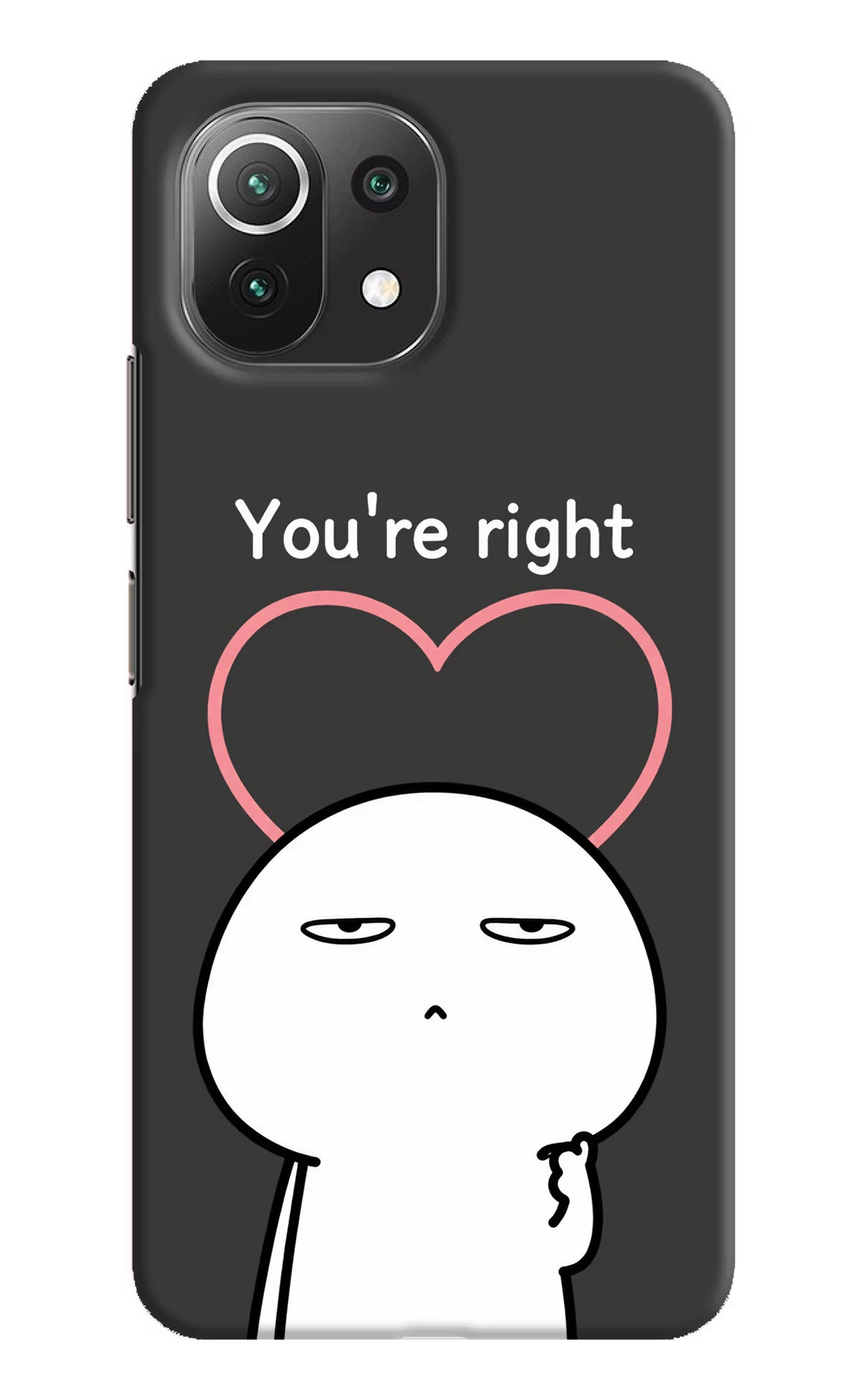 You're Right Mi 11 Lite NE 5G Back Cover