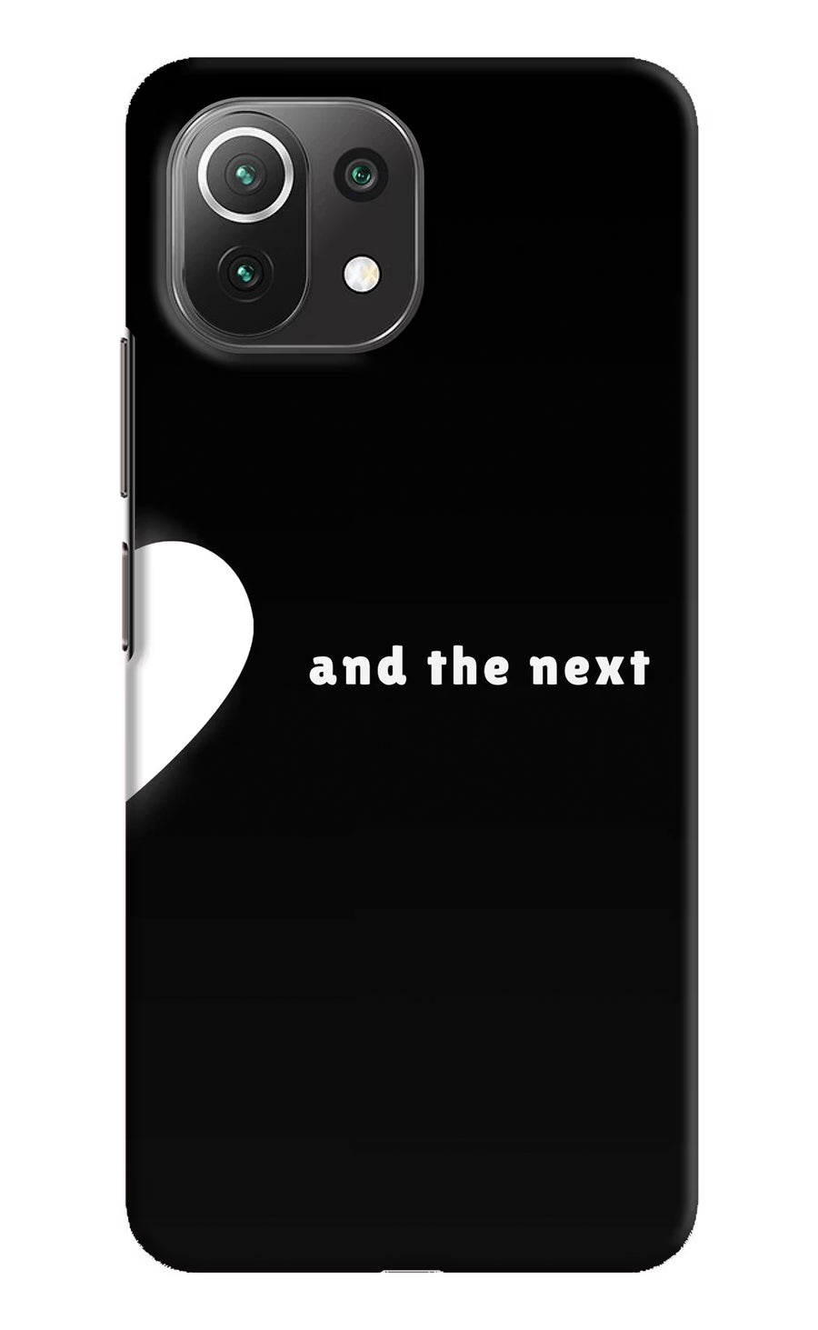 Next World Mi 11 Lite NE 5G Back Cover, Hard case