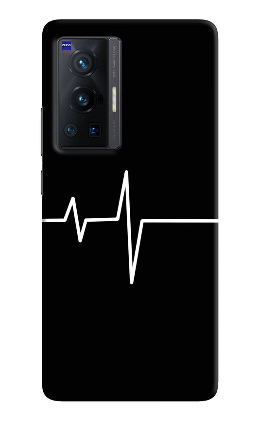 Heart Beats Vivo X70 Pro Hard Case Back Cover by Casekaro