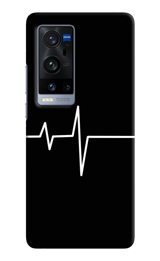 Heart Beats Vivo X60 Pro+ Hard Case Back Cover by Casekaro