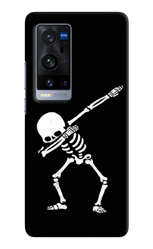 Dabbing Skeleton Art Vivo X60 Pro+ Hard Case Back Cover by Casekaro
