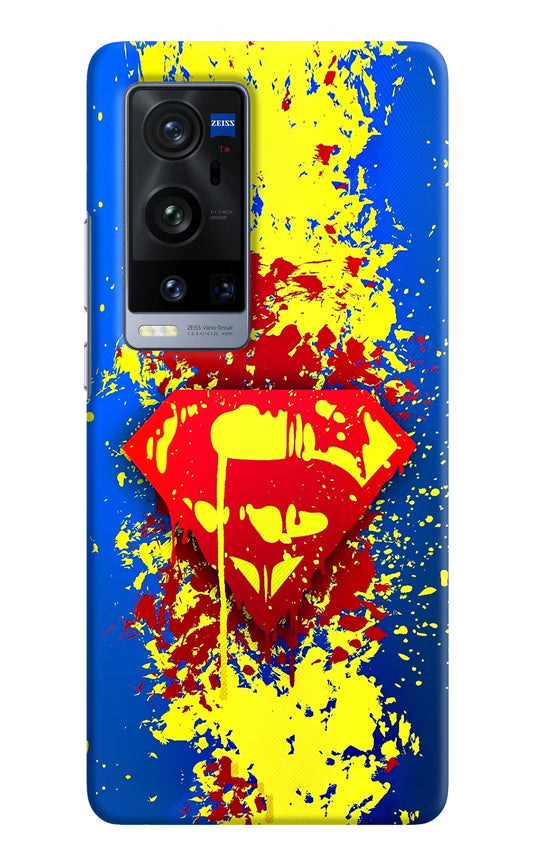 Superman logo Vivo X60 Pro+ Hard Case Back Cover by Casekaro