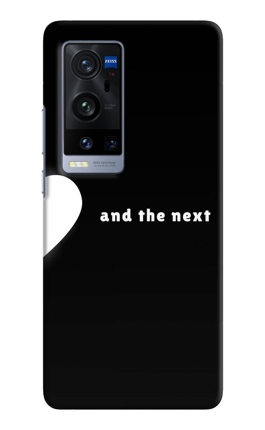 Next World Vivo X60 Pro+ Hard Case Back Cover by Casekaro