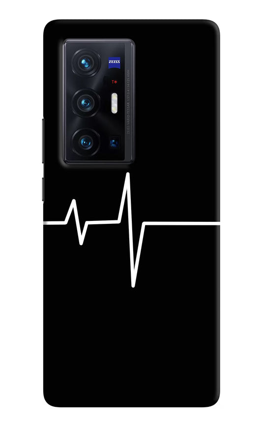 Heart Beats Vivo X70 Pro+ Hard Case Back Cover by Casekaro