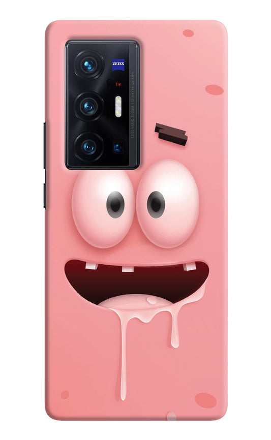 Sponge 2 Vivo X70 Pro+ Hard Case Back Cover by Casekaro