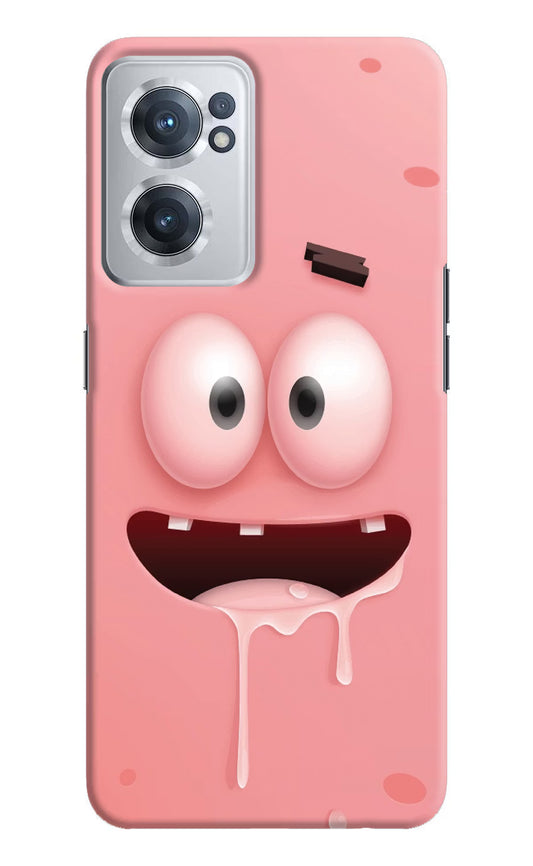 Sponge 2 OnePlus Nord CE 2 5G Hard Case Back Cover by Casekaro