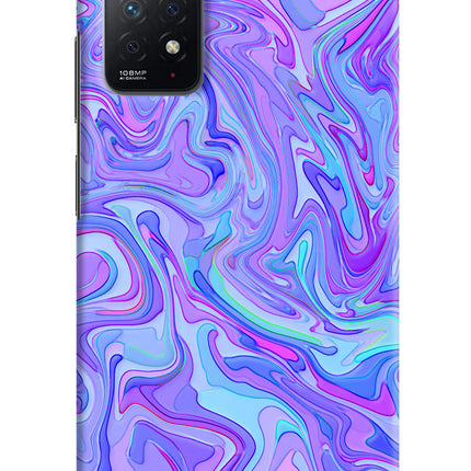 Glitter Redmi Note 11 Pro Hard Case Back Cover by Casekaro