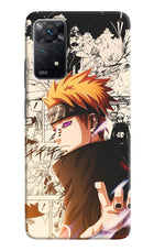Pain Anime Redmi Note 11 Pro Hard Case Back Cover by Casekaro