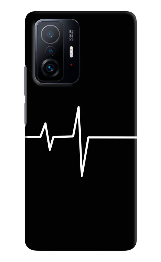 Heart Beats Mi 11T Pro 5G Hard Case Back Cover by Casekaro
