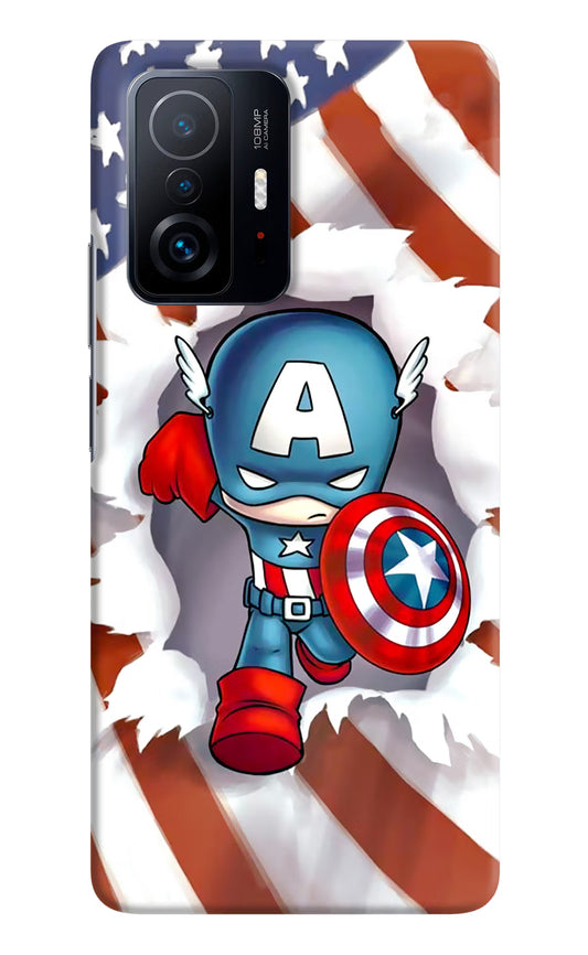Captain America Mi 11T Pro 5G Hard Case Back Cover by Casekaro