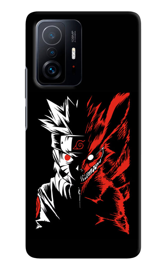Naruto Two Face Mi 11T Pro 5G Hard Case Back Cover by Casekaro