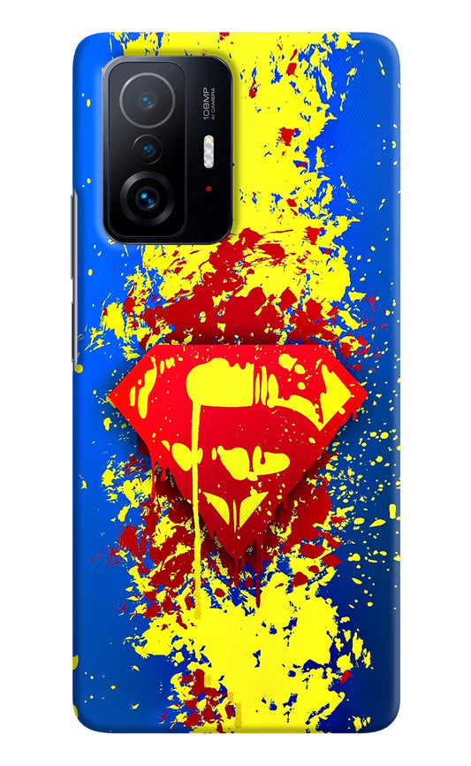 Superman logo Mi 11T Pro 5G Hard Case Back Cover by Casekaro