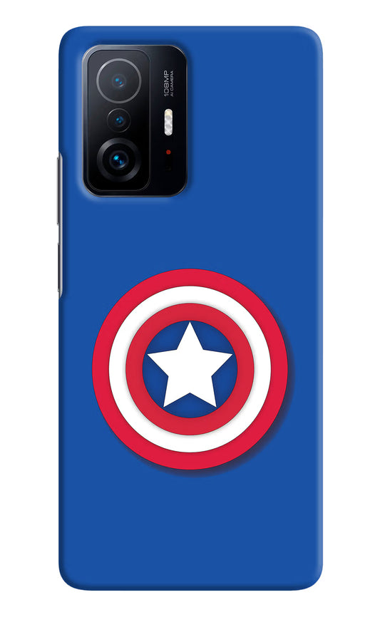 Shield Mi 11T Pro 5G Hard Case Back Cover by Casekaro