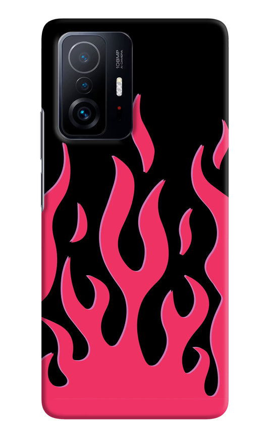 Fire Flames Mi 11T Pro 5G Hard Case Back Cover by Casekaro