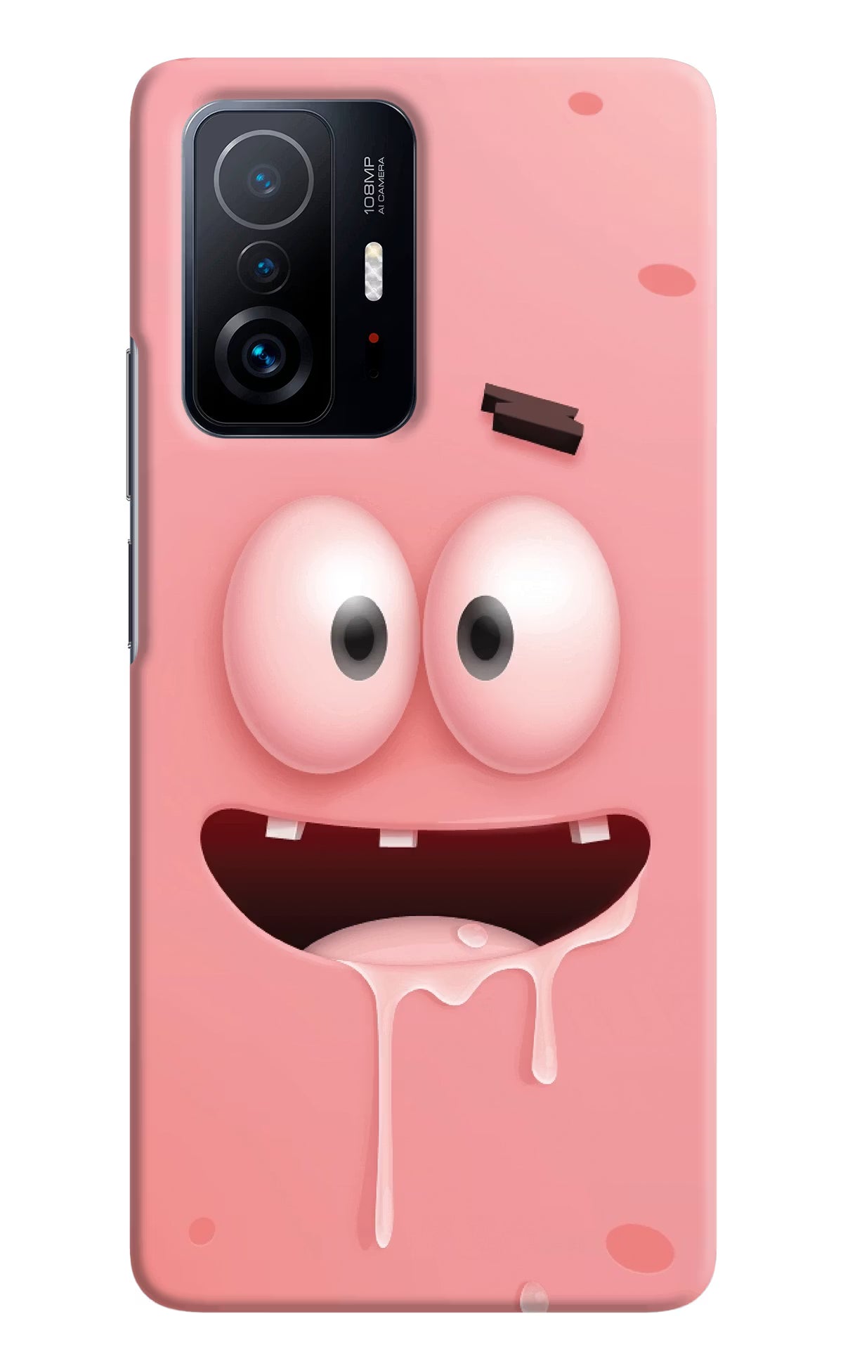 Sponge 2 Mi 11T Pro 5G Hard Case Back Cover by Casekaro