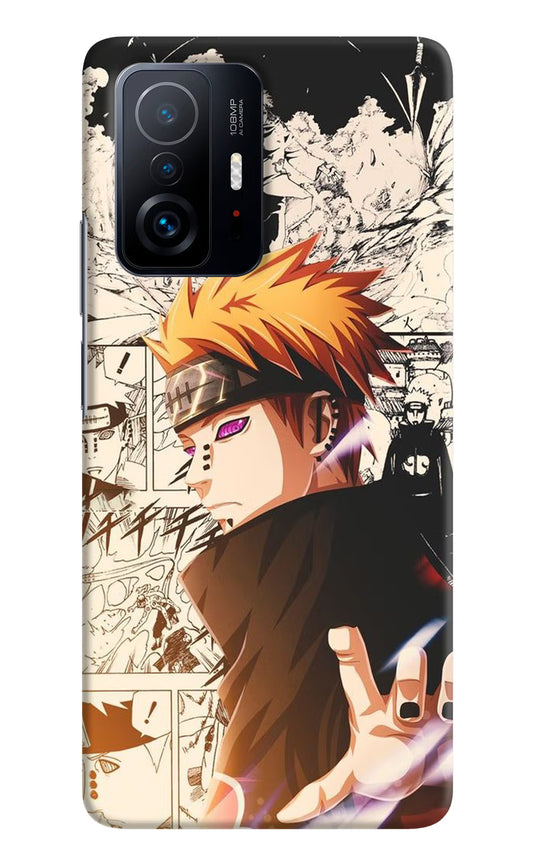 Pain Anime Mi 11T Pro 5G Hard Case Back Cover by Casekaro