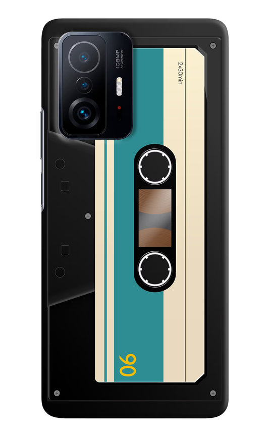 Cassette Mi 11T Pro 5G Hard Case Back Cover by Casekaro