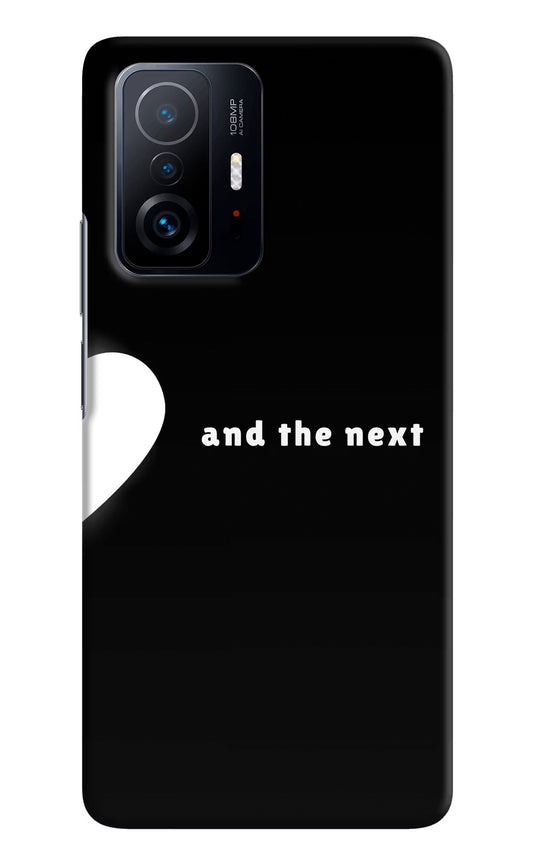 Next World Mi 11T Pro 5G Hard Case Back Cover by Casekaro