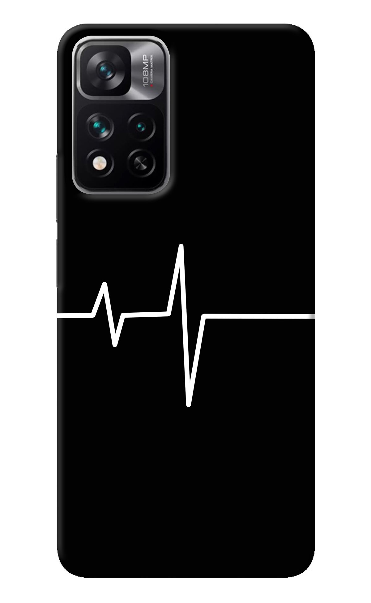 Heart Beats Mi 11i 5G/11i 5G Hypercharge Back Cover