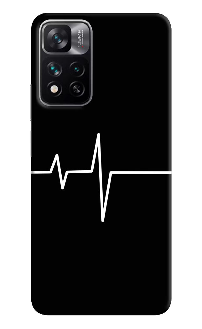 Heart Beats Mi 11i 5G/11i 5G Hypercharge Hard Case Back Cover by Casekaro