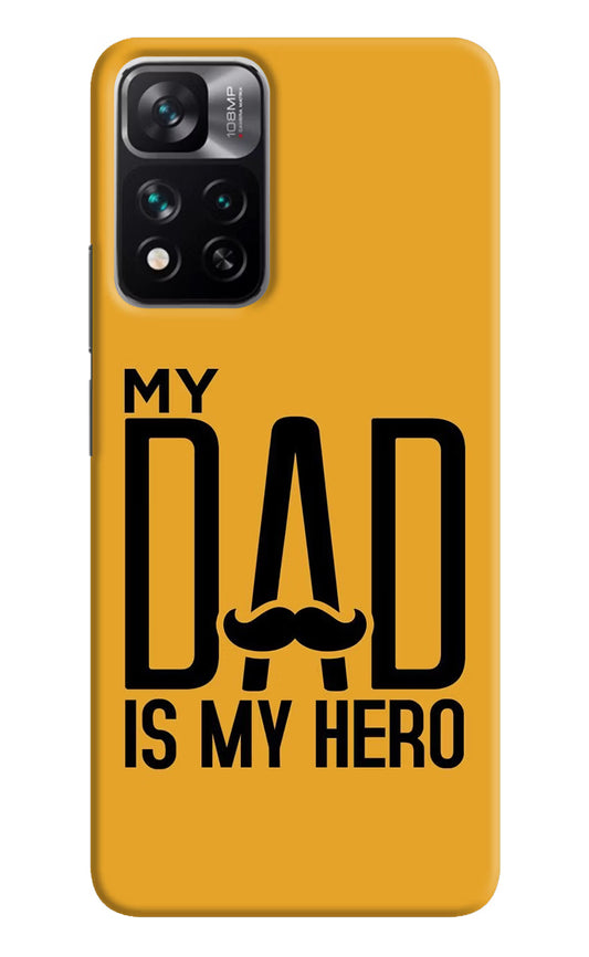 My Dad Is My Hero Mi 11i 5G/11i 5G Hypercharge Hard Case Back Cover by Casekaro