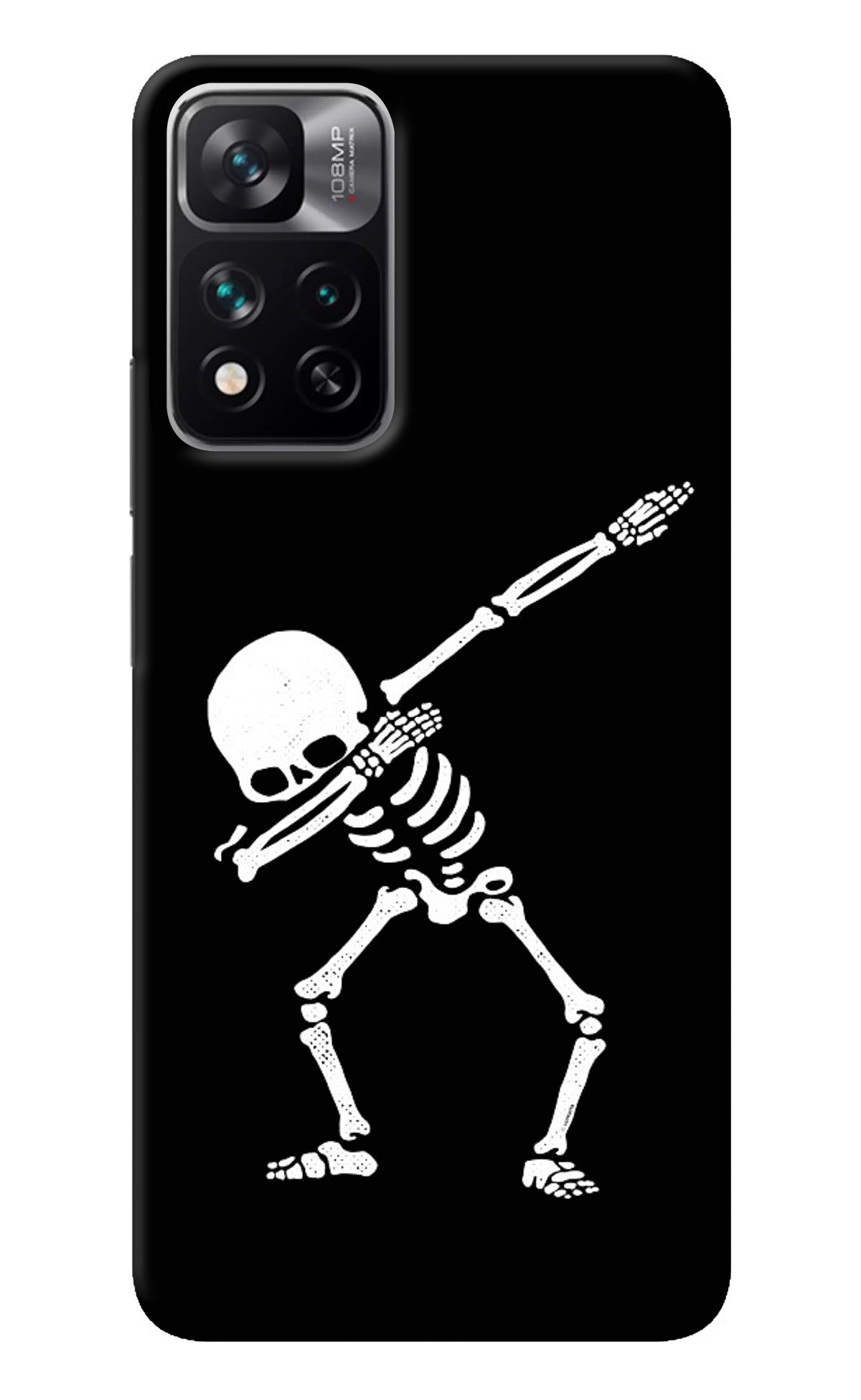 Dabbing Skeleton Art Mi 11i 5G/11i 5G Hypercharge Back Cover