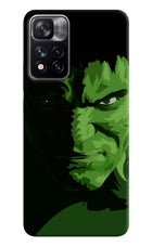 HULK Mi 11i 5G/11i 5G Hypercharge Hard Case Back Cover by Casekaro