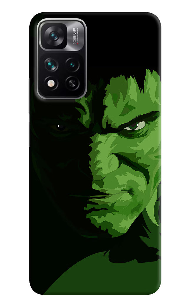 HULK Mi 11i 5G/11i 5G Hypercharge Hard Case Back Cover by Casekaro