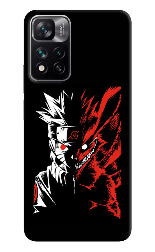 Naruto Two Face Mi 11i 5G/11i 5G Hypercharge Hard Case Back Cover by Casekaro
