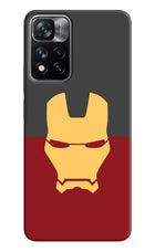 Ironman Mi 11i 5G/11i 5G Hypercharge Hard Case Back Cover by Casekaro