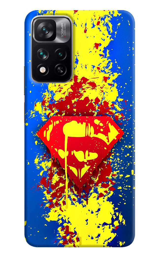 Superman logo Mi 11i 5G/11i 5G Hypercharge Hard Case Back Cover by Casekaro