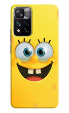 Sponge 1 Mi 11i 5G/11i 5G Hypercharge Hard Case Back Cover by Casekaro