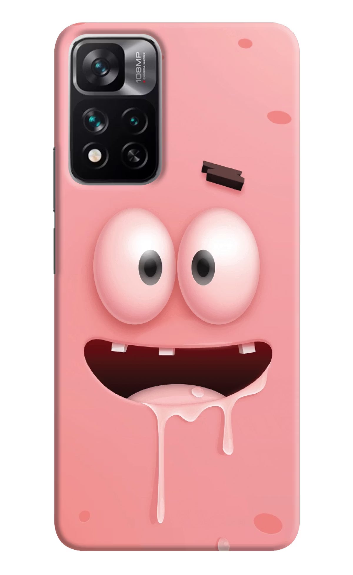 Sponge 2 Mi 11i 5G/11i 5G Hypercharge Hard Case Back Cover by Casekaro