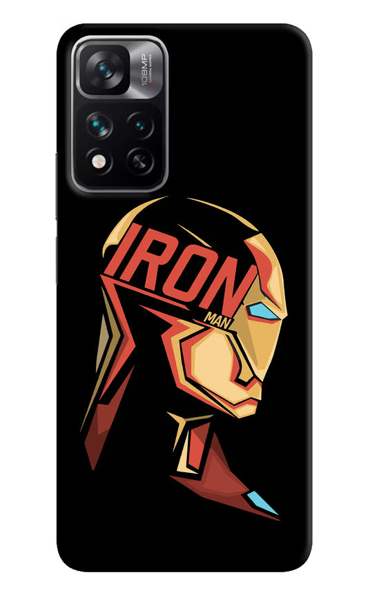 IronMan Mi 11i 5G/11i 5G Hypercharge Hard Case Back Cover by Casekaro