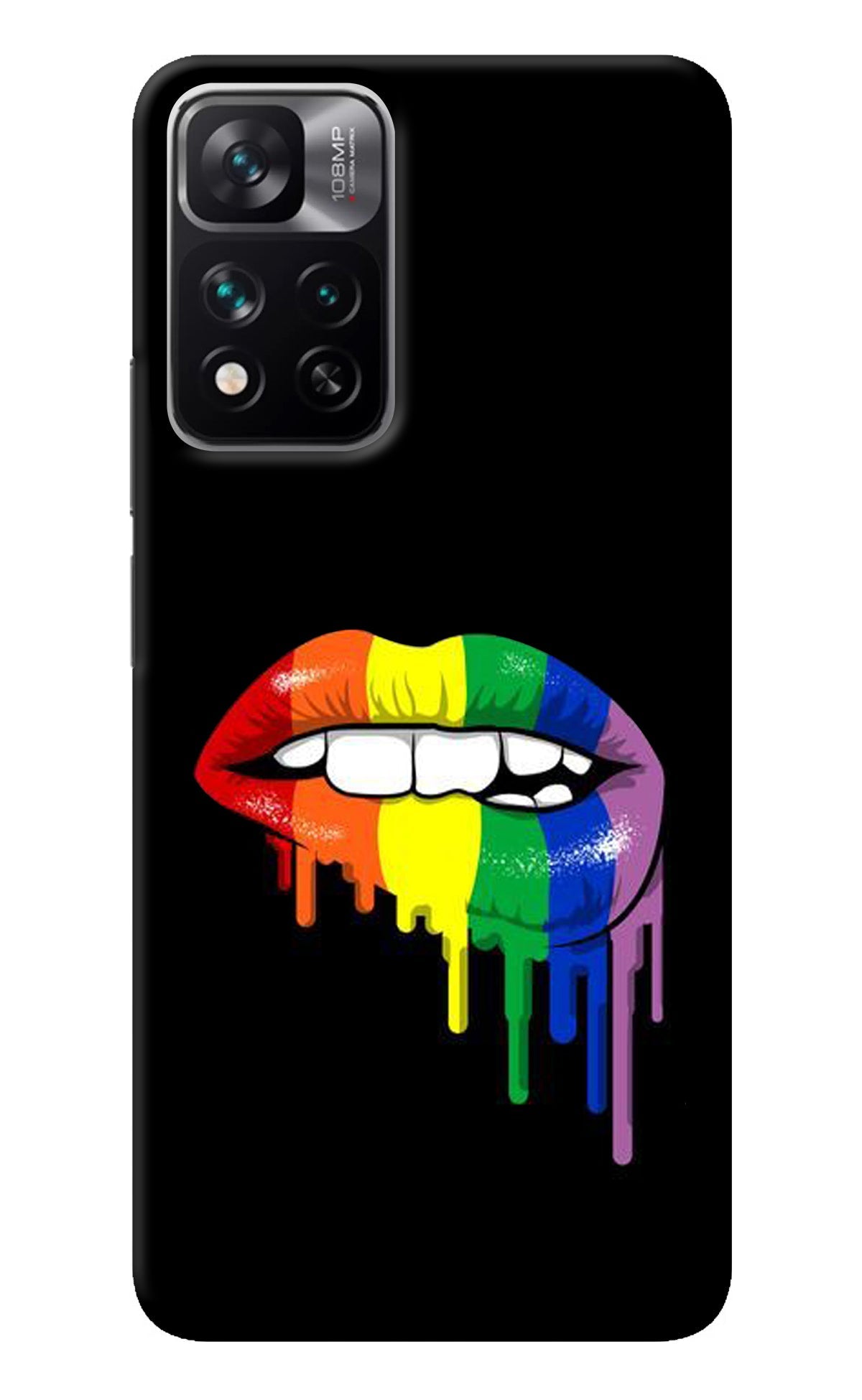 Lips Biting Mi 11i 5G/11i 5G Hypercharge Back Cover