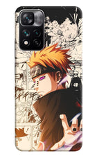 Pain Anime Mi 11i 5G/11i 5G Hypercharge Hard Case Back Cover by Casekaro