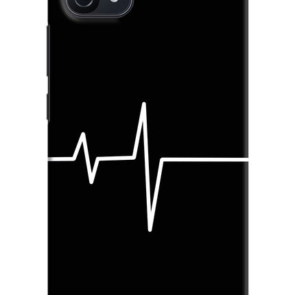 Heart Beats Oppo A16k/A16e Hard Case Back Cover by Casekaro