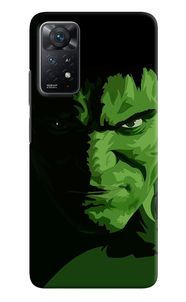 HULK Redmi Note 11 Pro+ 5G Hard Case Back Cover by Casekaro