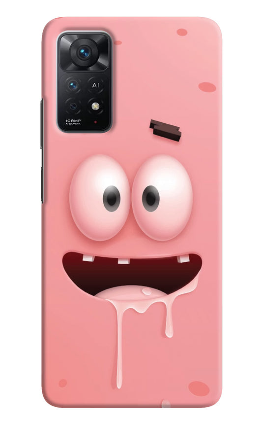 Sponge 2 Redmi Note 11 Pro+ 5G Hard Case Back Cover by Casekaro