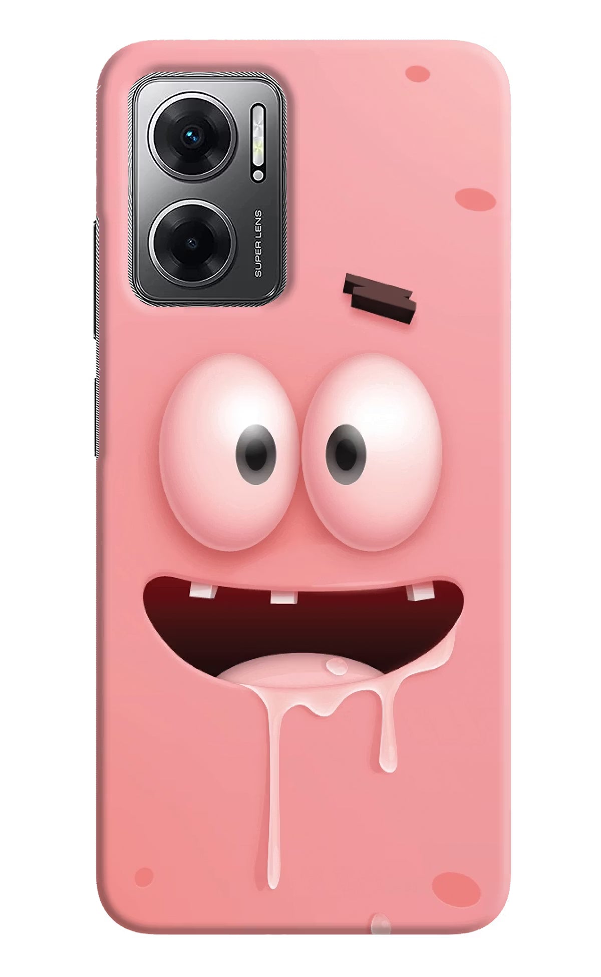 Sponge 2 Redmi 11 Prime 5G Hard Case Back Cover by Casekaro