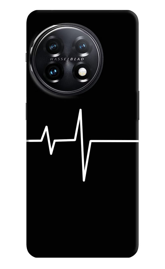 Heart Beats OnePlus 11 5G Hard Case Back Cover by Casekaro