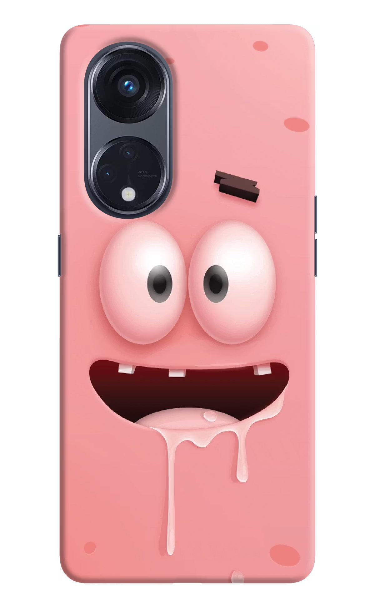 Sponge 2 Oppo Reno8 T 5G Hard Case Back Cover by Casekaro