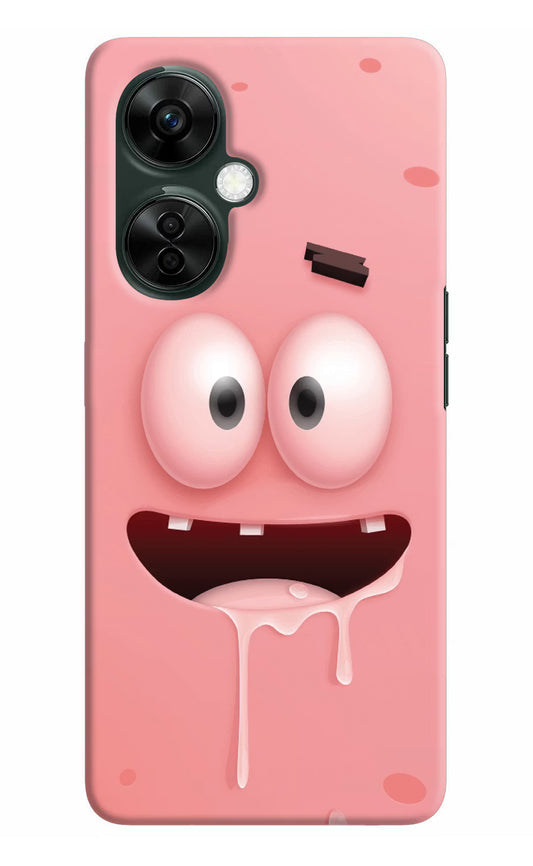 Sponge 2 OnePlus Nord CE 3 Lite 5G Hard Case Back Cover by Casekaro