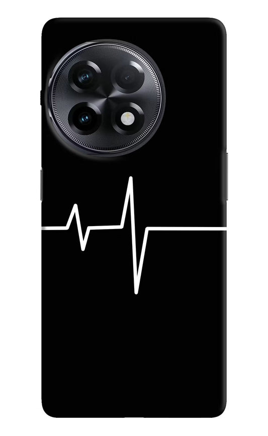 Heart Beats OnePlus 11R Hard Case Back Cover by Casekaro