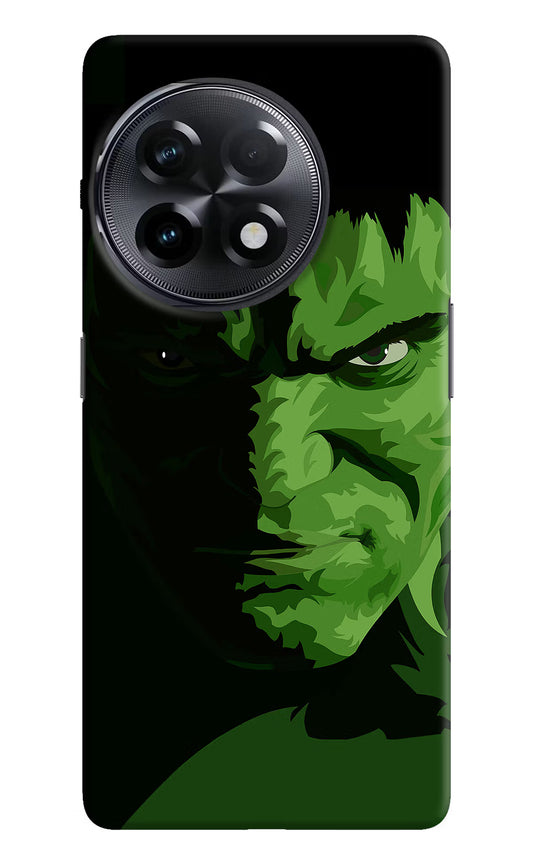 HULK OnePlus 11R Hard Case Back Cover by Casekaro
