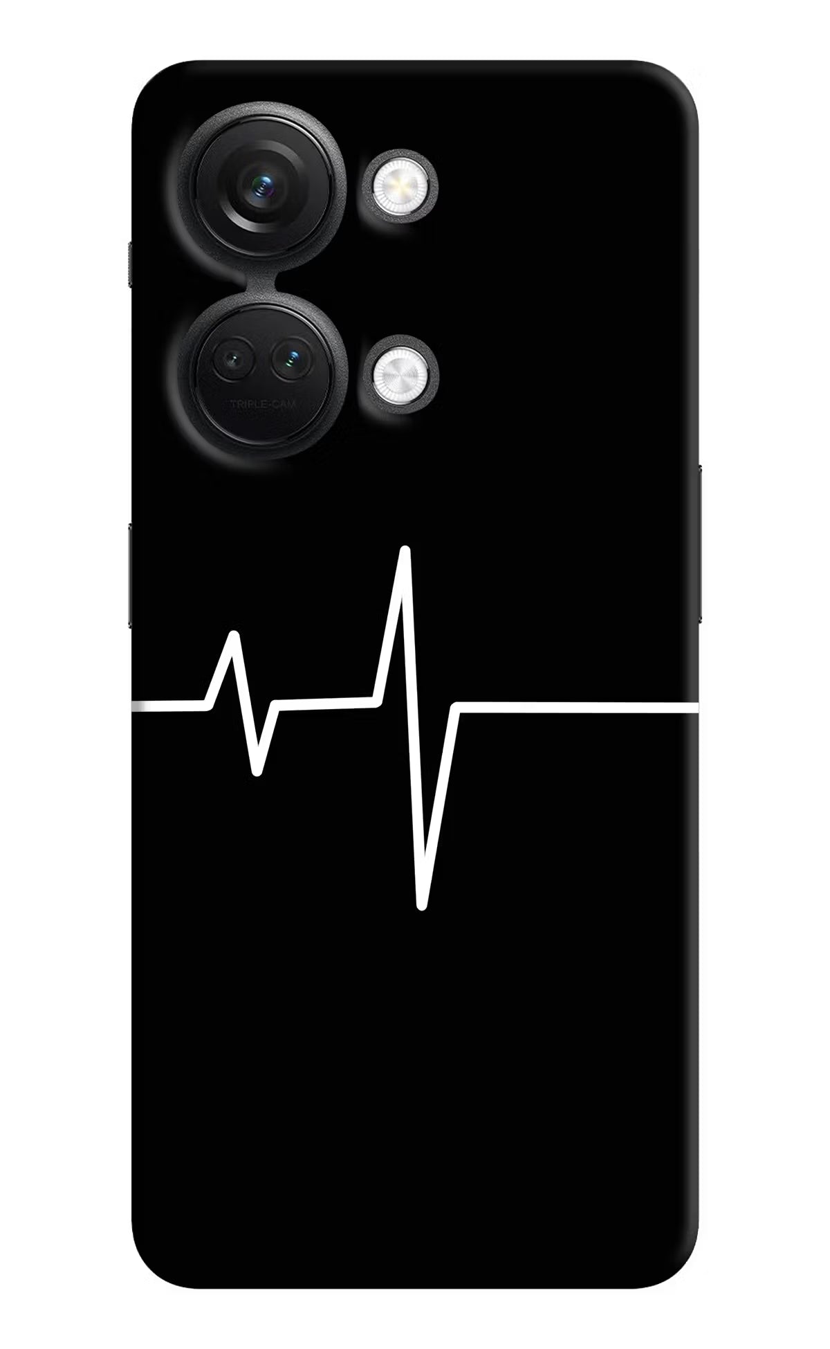 Heart Beats OnePlus Nord 3 5G Hard Case Back Cover by Casekaro